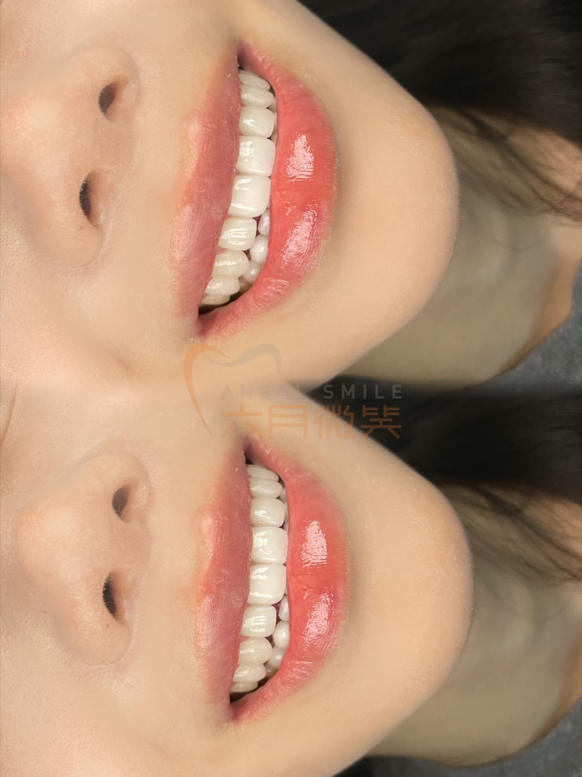 琥珀瓷授权案例记录 18