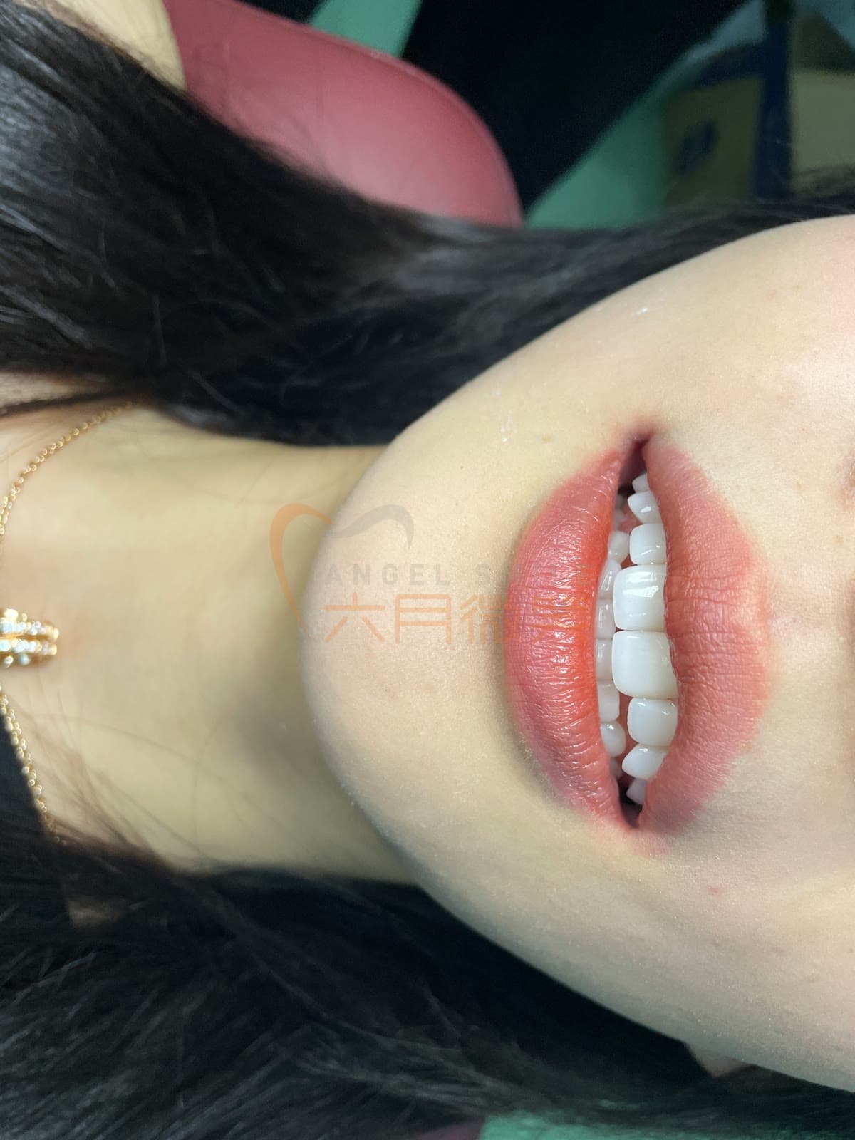 琥珀瓷授权案例记录 21