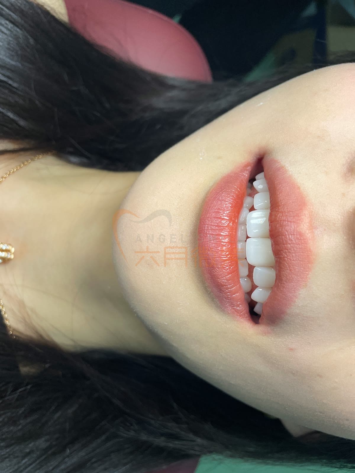 琥珀瓷授权案例记录 22