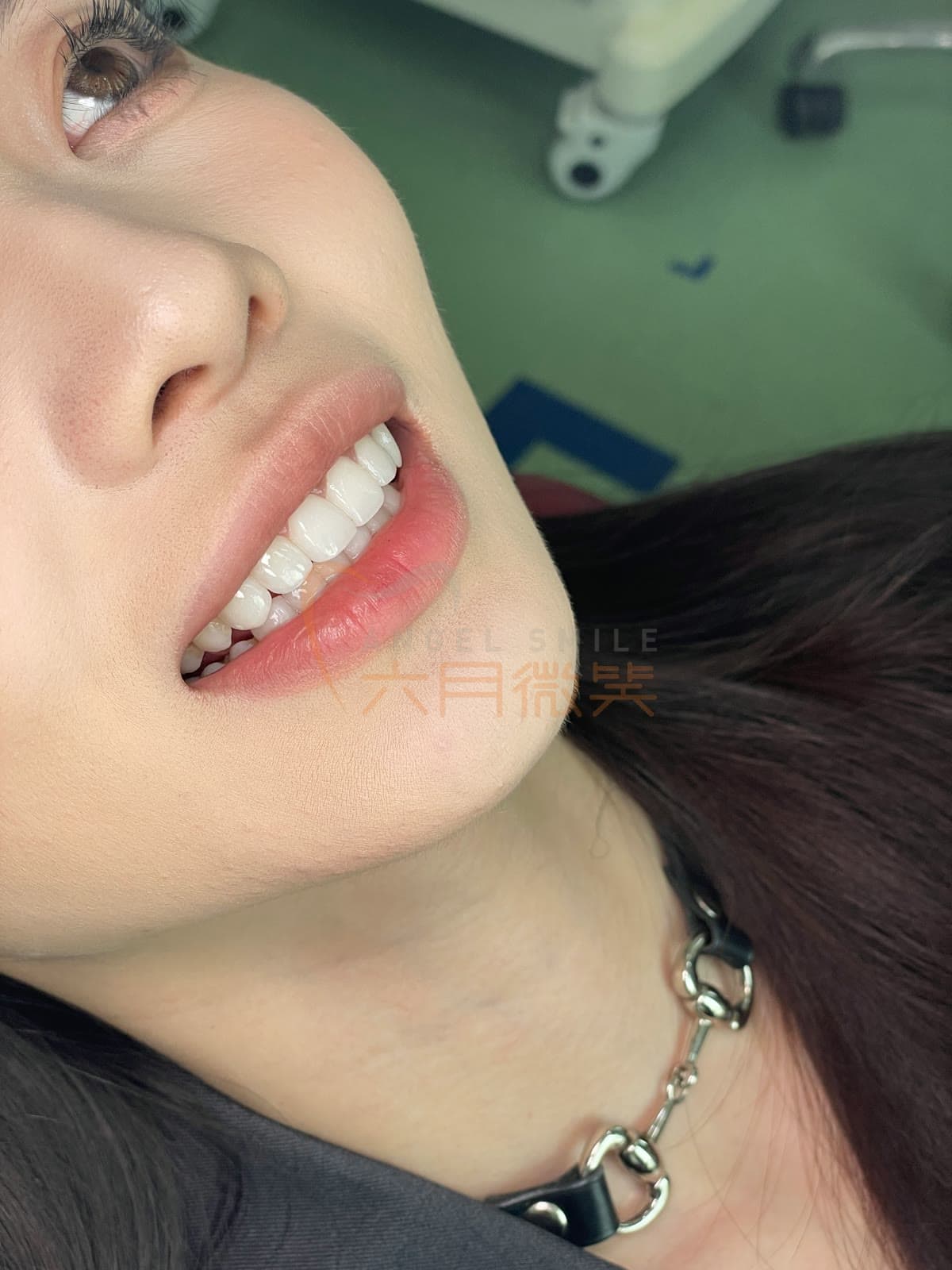 玻璃瓷授权案例记录 11
