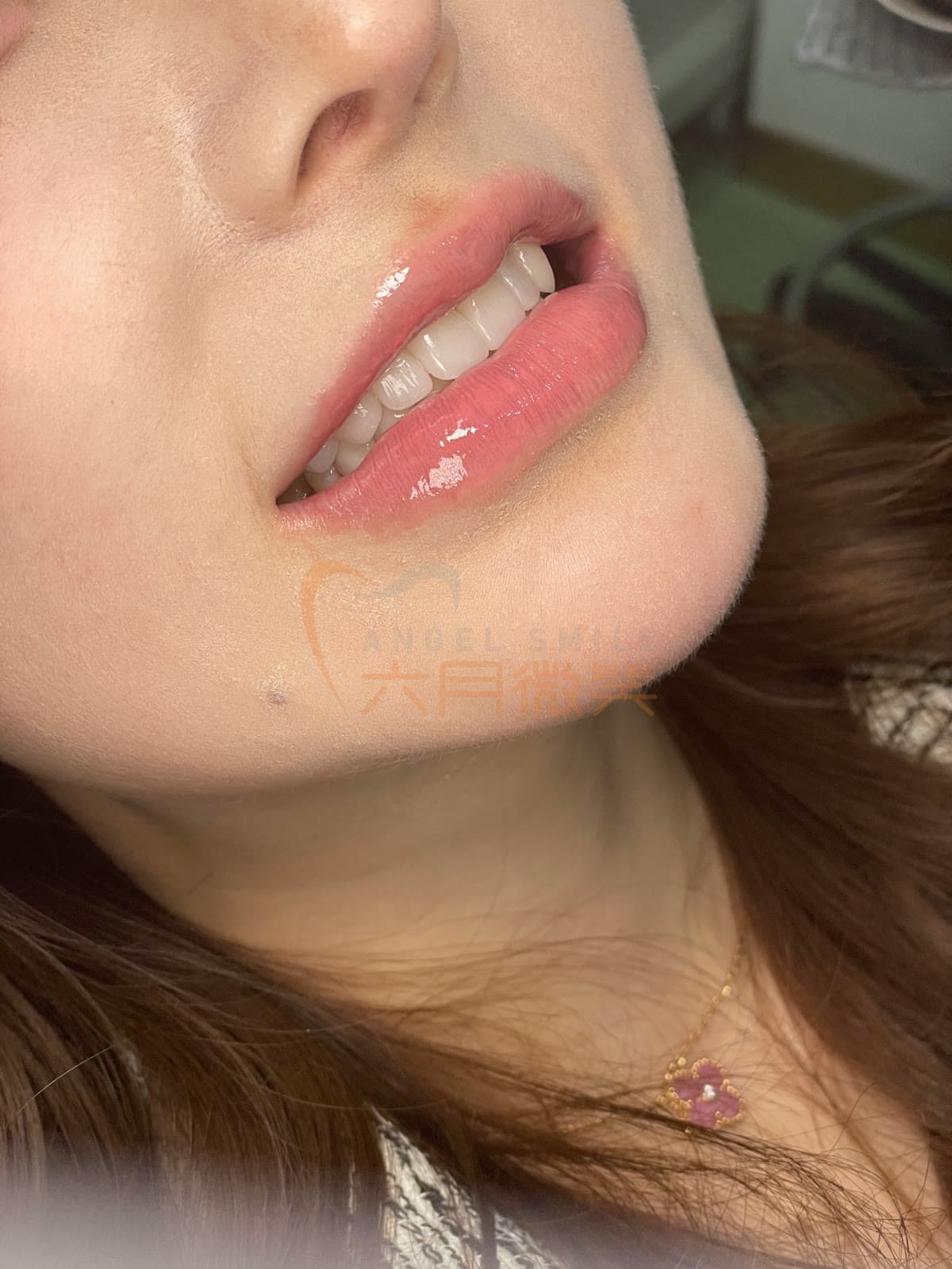 玻璃瓷授权案例记录 12
