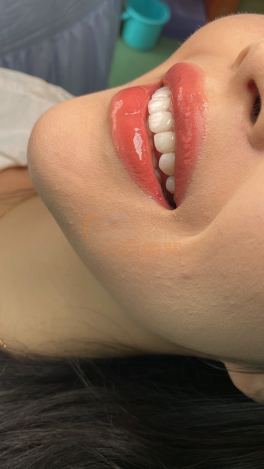 零感微瓷授权案例记录 26